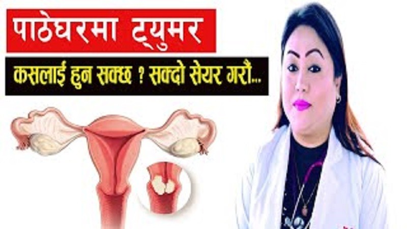 कसलाई हुनसक्छ पाठेघरमा ट्युमर :- Dr Rangina Laikangbam - Endoscopic Gynecologist & Infertility Specialist